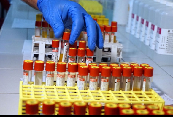 Koronavirs Laboratuvarnda antikor testi yaplmaya baland 