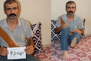 nce ayaklarn kaybetti ardndan hayallerini