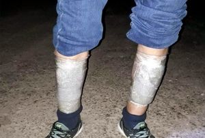 Uyuturucu taciri jandarma ekiplerini artt