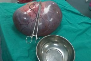 Kilo aldn sanan kadnda 9 kilo kitle kt