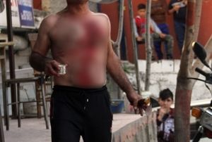 Hem kendini kesti hem Trk kahvesi iti 