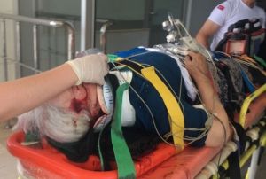 Kayseri'de trafik kazas: 5 yaral