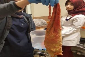 Hastann karnnda havlu byklnde sarg bezi unutmular