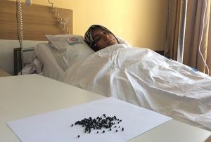 Gen kadnn safra kesesinden 200 tane ta kt