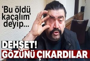 Asker uurlamasnda   tarttklar adamn gzn kardlar