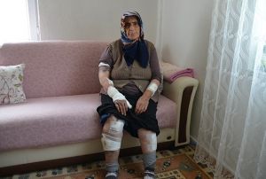 Kpeklerin saldrd yal kadn lmden komular kurtard