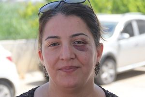 Yaralya mdahale eden hemire bu hale getirildi