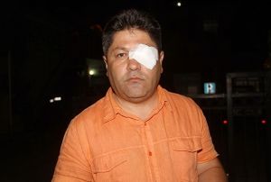 Gazeteciler Cemiyet Bakanna Saldr