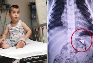 3 yandaki Yasin eker sanp engelli ine yuttu