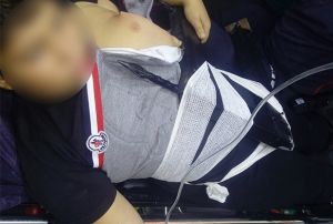 zerinden atlamak istedii demir korkuluklar ocuun vcuduna sapland