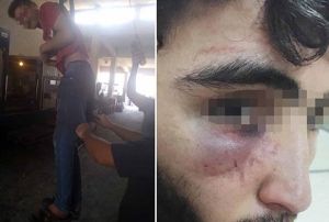 15 yandaki raa palangal ikence, aabeyine dayak iddias
