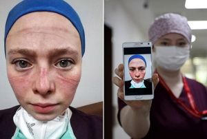 Youn bakm alma zorluu yzne yansyan Seher hemireye vg