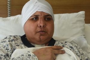 Kazada ikiye ayrlan yz, ameliyatla birletirildi