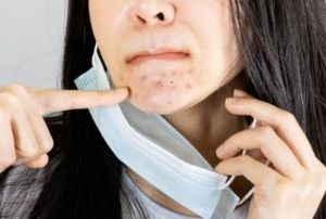 Maske kullanrken cilt sorunlar nasl nlenir?