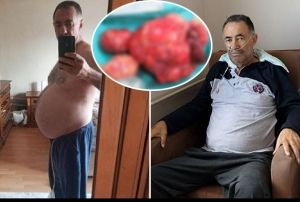 Kilo ikayetiyle hastaneye gitti, karnndan 35 kilo tmr karld 