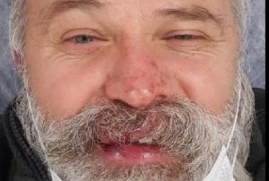 Sendika genel bakan yardmcsna yumruklu saldr  