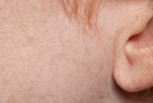 K cilt bakmnn pf noktalar