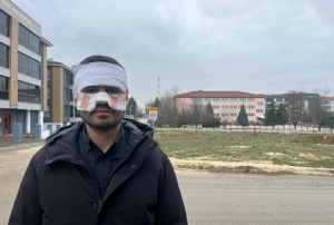 Fizik öğretmeni feci şekilde yandı