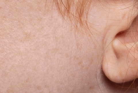 K cilt bakmnn pf noktalar