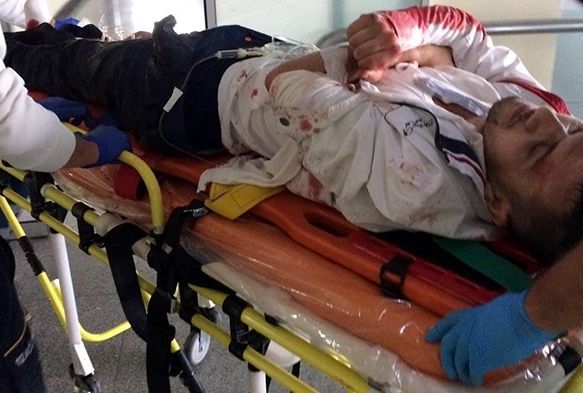 Kayseri'de silahlı kavga: 1 yaralı