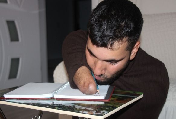 Kollar ve bacaklar yok ama azmi var