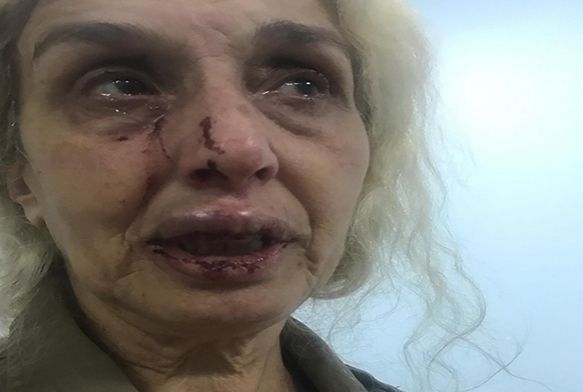 Sokak hayvanlarn beslerken baka kadnlarn saldrsna urad