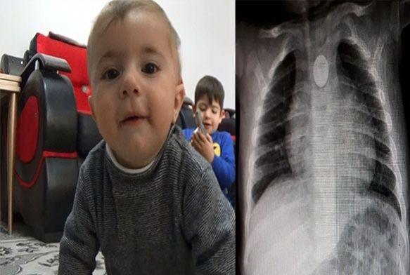 1 lira yznden lyordu...Hayata byle dnd