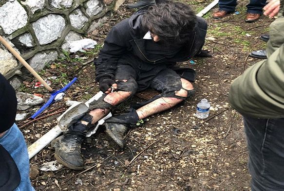 Üniversite öğrencisi köpek saldırısıyla yaralandı