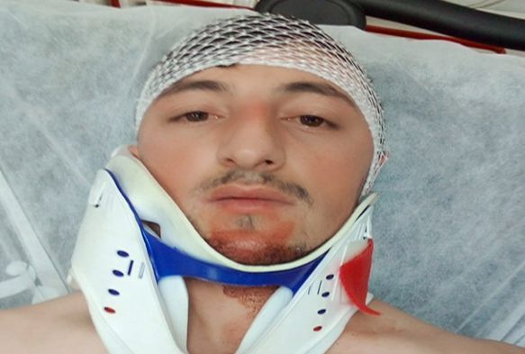Kayseri'de esnaf kavgası: 1 yaralı