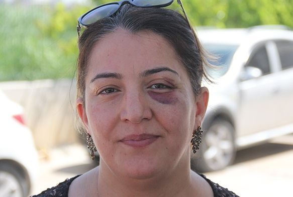 Yaralya mdahale eden hemire bu hale getirildi