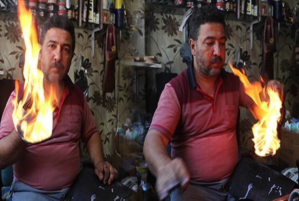 Ayakkablar yakyor mrn 9 ay uzatyor
