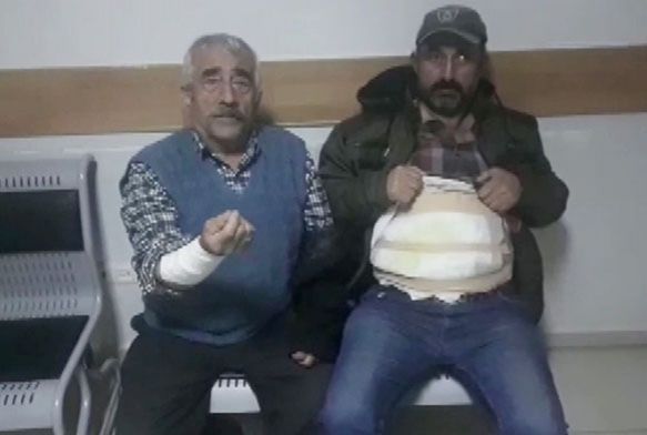 Cani koca eini darp edip ailesini kaynar su dkerek yakt
