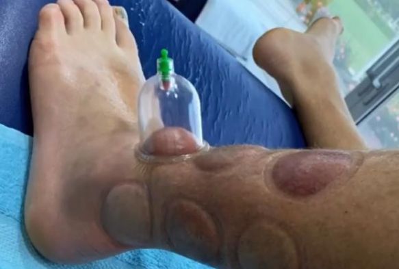 Pedro Henrique tedavi oluyor
