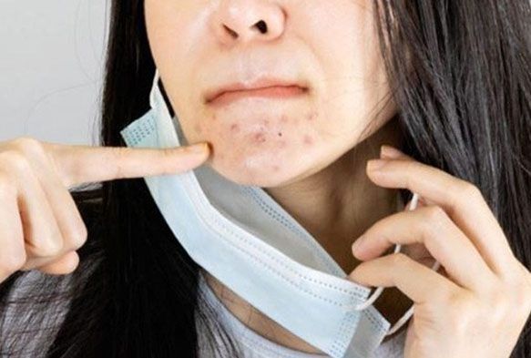 Maske kullanrken cilt sorunlar nasl nlenir?