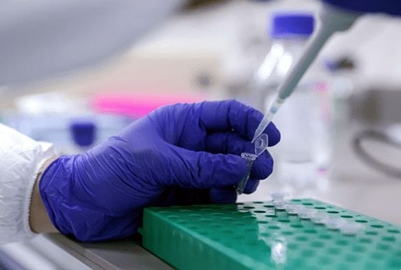 A olmayan iiden haftada bir PCR testi istenecek
