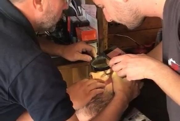 Gözüne kaçan cismi tornacıda çıkardılar