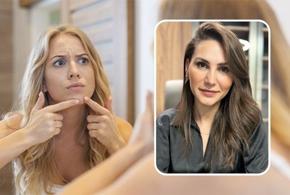 “Sivilce ergenliğe özgü bir durum değil, bir hastalıktır”