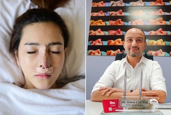 Kışın Burun Ameliyatı Olmak Daha Avantajlı