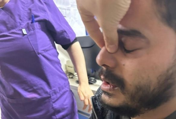 Darp edilen doktorun burnu kırıldı