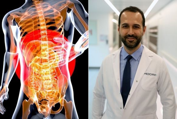 Refl şikyetine 30 dakikalık tedavi nerisi