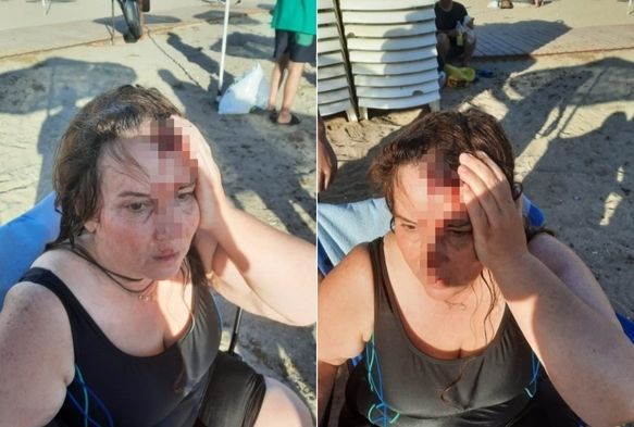 Denizde Yzerken Jet Ski arptı!