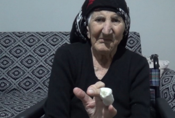 Parmağı MR'a Sıkıştı!