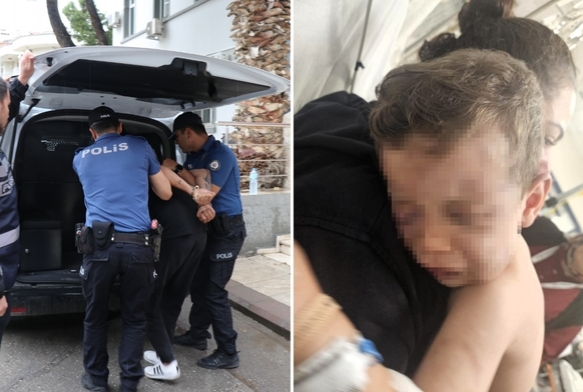2 Yaşındaki Çocuğa Darp!