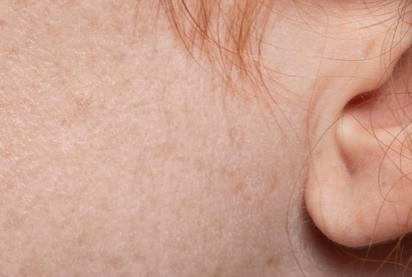 K cilt bakmnn pf noktalar