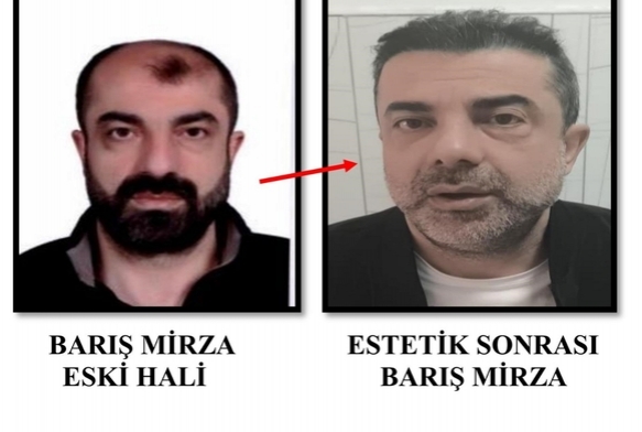 Ameliyat ile y�z�n� de�i�tirmi�...